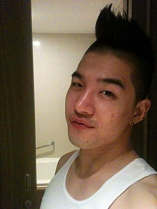 11 mỹ nam, mỹ nữ Hàn có làn da bị "giặc mụn" tàn phá - 9