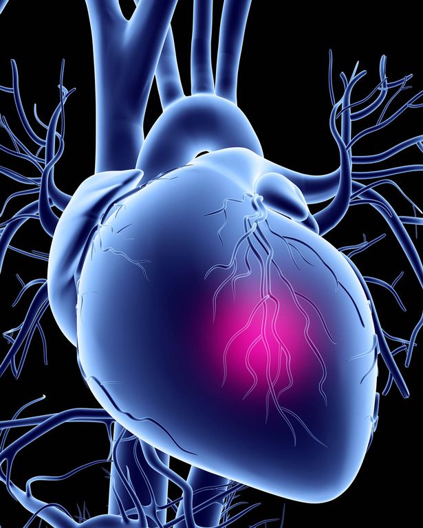 Vui sướng quá cũng nguy hiểm cho tim - 3