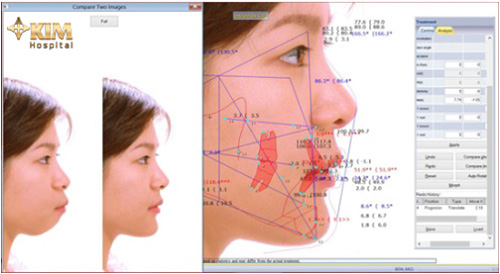 Độn cằm, trượt cằm không lo về giá nhân dịp 8/3 - 3