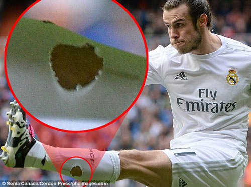 Chuyện lạ: Đắt giá nhất thế giới, Bale đi tất "rách" - 1