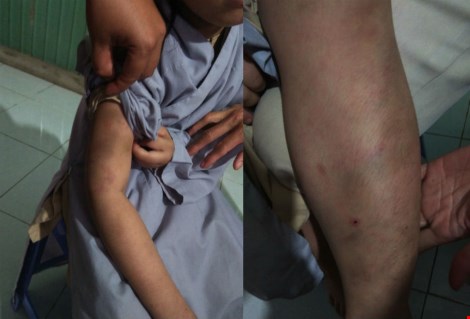 Bé gái 7 tuổi bị đánh bầm tím trong cơ sở tu tại gia - 1