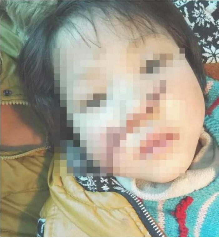 Bé gái lấy cưa tấn công em vì bắt chước phim hoạt hình - 1