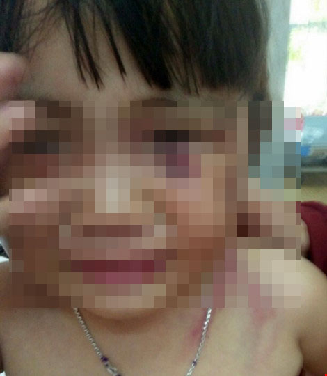 Bé gái 3 tuổi bị cha dượng đánh dã man để ‘trả thù’! - 1