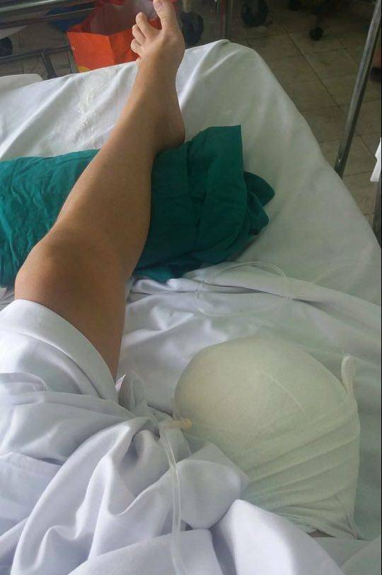 Đau đớn nữ sinh mất chân vì bệnh viện tắc trách - 1