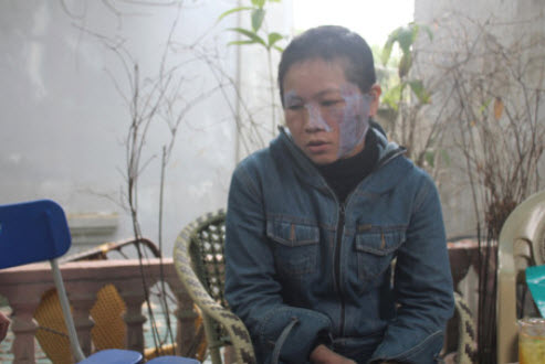 Nghệ An: Chồng tra tấn vợ dã man - 1