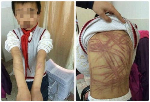 “Mẹ hổ” đánh đập con dã man đã được ra tù - 3
