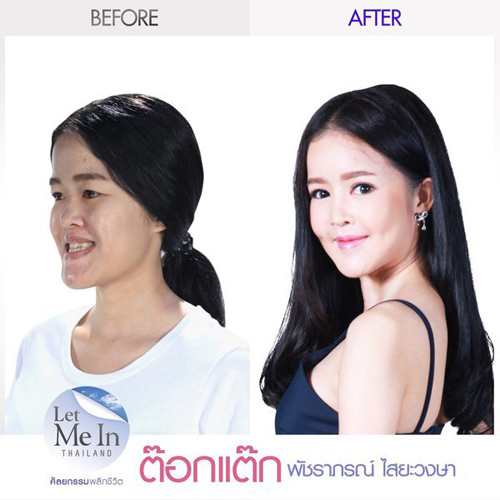 Thiếu nữ Thái rũ bỏ vẻ già nua thành mỹ nữ xinh như hoa - 5