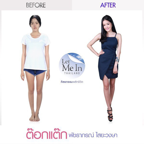 Thiếu nữ Thái rũ bỏ vẻ già nua thành mỹ nữ xinh như hoa - 6