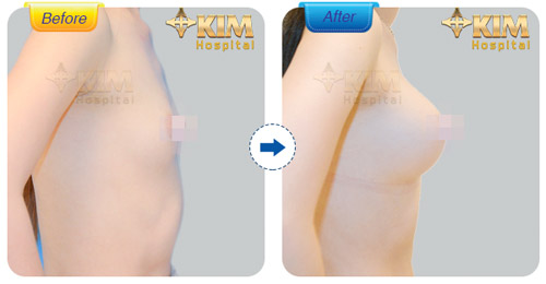 20 cơ hội phẫu thuật thẩm mỹ miễn phí 100% từ KIM Hospital - 4
