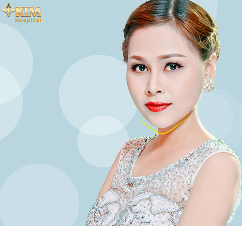 20 cơ hội phẫu thuật thẩm mỹ miễn phí 100% từ KIM Hospital - 5