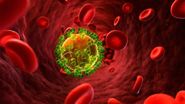 Lần đầu tiên tìm ra phương pháp diệt tận gốc HIV - 1