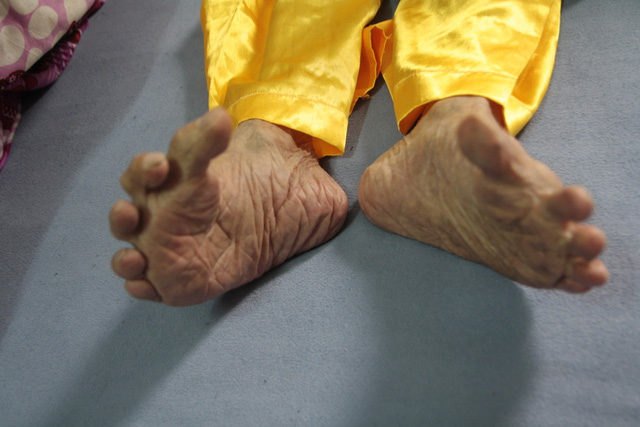 Cụ ông 104 tuổi "chân Giao Chỉ" cả đời không đi vừa giày dép - 2