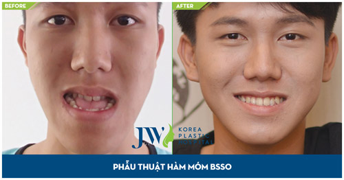 Những điểm nhấn tạo nên bệnh viện thẩm mỹ chuẩn quốc tế JW - 7