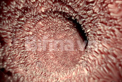 Giải pháp của người Nhật giúp nhiều người thoát khỏi viêm đại tràng - 2