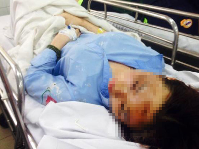 Nữ sinh bị tạt axit ở TPHCM: Mối nghi ngờ của nạn nhân - 1