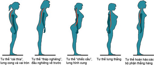 Nghiên cứu mới “bóc mẽ” nguyên nhân bạn bị đau lưng - 1