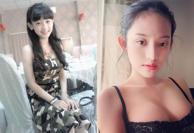 Thúy Vi (sinh năm 1997) nổi tiếng từ scandal xen vào cuộc tình đẹp của hot girl Midu và thiếu gia Phan Thành. Bên cạnh đó, cô gái Cà Mau còn được chú ý bởi độ chịu chơi, chịu chi khi mới 19 tuổi đã trải qua hàng loạt cuộc "trùng tu" nhan sắc. 