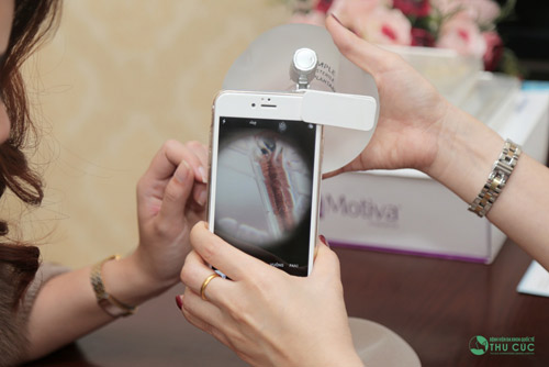 Điều đặc biệt của túi độn nâng ngực thông minh Nano Chip - 3