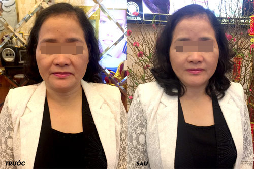 Trung tâm thẩm mỹ quá tải khách ngay từ những ngày đầu khai xuân - 4