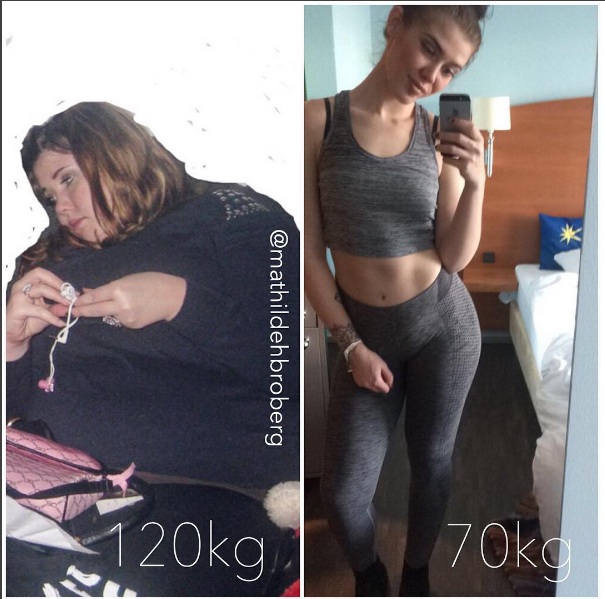Nữ sinh Đan Mạch béo phì gây choáng khi giảm gần 60kg - 1