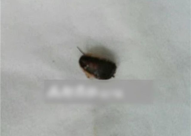 Tự xịt thuốc diệt côn trùng vào lỗ tai để giết gián - 3