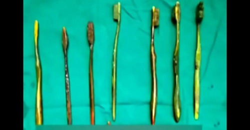 Cô gái nuốt 7 chiếc bàn chải vì bị cha mẹ ép duyên - 1