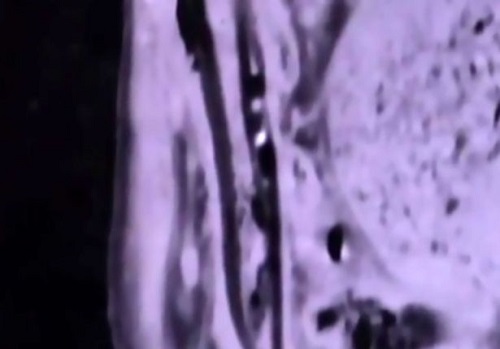 Cô gái nuốt 7 chiếc bàn chải vì bị cha mẹ ép duyên - 3