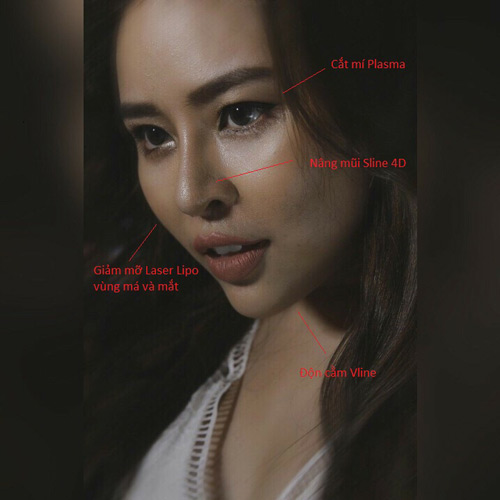 Hé lộ câu chuyện giảm 20kg của Thái Bảo Trâm đang gây 'sốt' - 6