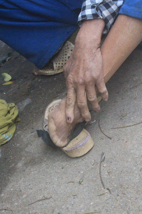 Những mảnh đời u sầu trong &#34;trại phong Quả Cảm&#34; - 2
