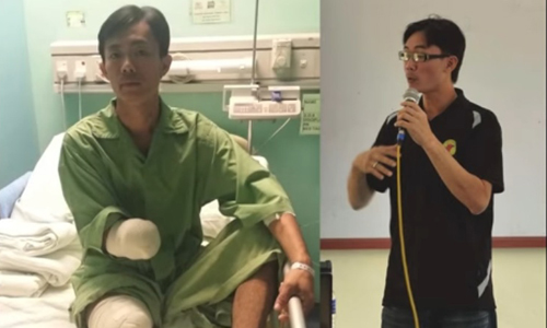 Người mất tay, chân vì cá sấu kể lại giây phút kinh hoàng - 2