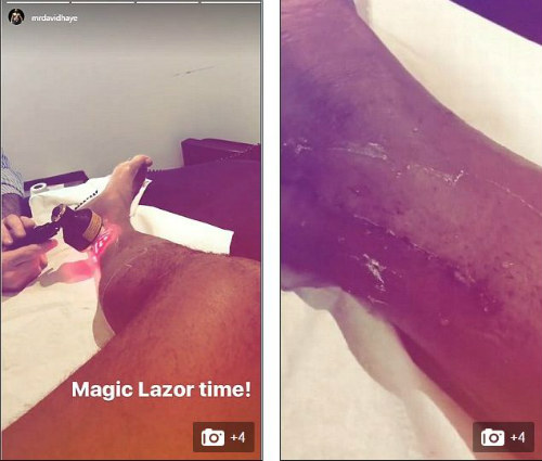 Tin thể thao HOT 22/3: Vợ chồng Tiến Minh thắng giòn giã - 2