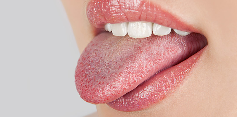 Vì sao bác sĩ khám bệnh hay xem lưỡi bệnh nhân? - 1