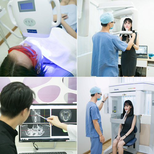 HOT: Cơ hội niềng răng, trồng răng miễn phí 100% - 5
