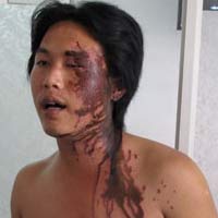 Pháp luật - "Tạt axit phải xử tử hình!"