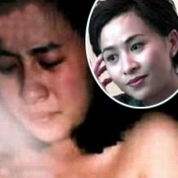  - Đau đớn tình dục ám ảnh sao Hoa