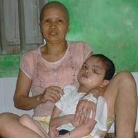 Sức khỏe đời sống - Đạp xích lô nuôi con bại não, vợ ung thư