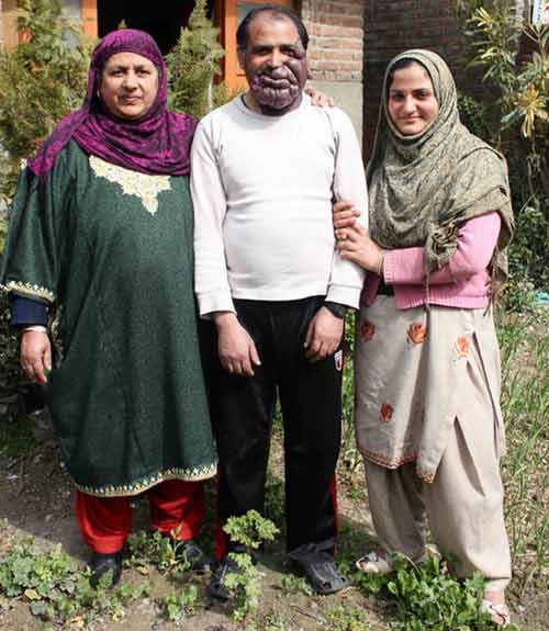 Người đàn ông với khối u khổng lồ trên mặt - 4