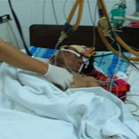 Sức khỏe đời sống - Tử vong do dùng thuốc Đông y chữa đột quỵ