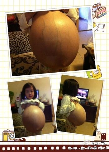 Bé gái 8 tuổi bụng to vượt mặt - 2