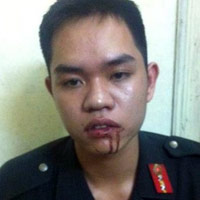 Tin tức trong ngày - CSCĐ bị nữ sinh đấm: Tôi rất bất ngờ!