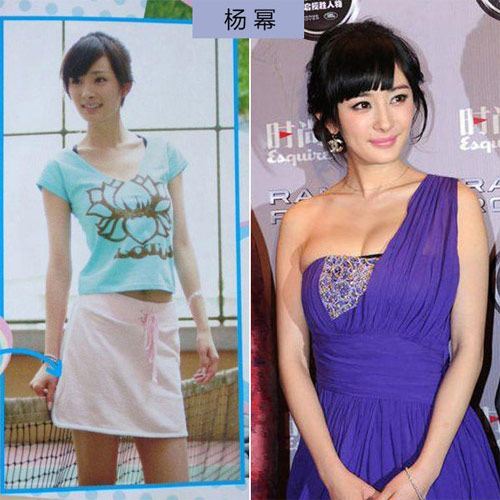 Ngực lép "ép" thành ngực căng - 7