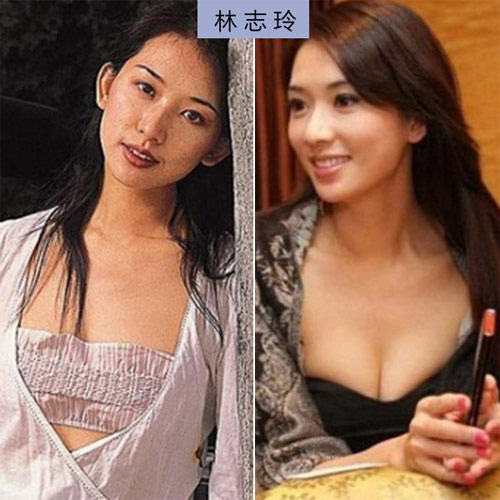 Ngực lép "ép" thành ngực căng - 10