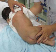 Sức khỏe đời sống - Ngộ độc vì dùng thuốc lào tẩy lông