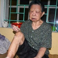 Tin tức trong ngày - Bệnh nhân phong bị "ép" ăn thịt sống?