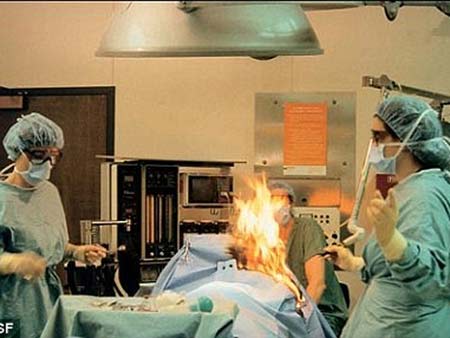 Bác sĩ đốt bệnh nhân trên bàn phẫu thuật - 1