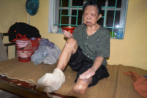 BN bị "ép" ăn thịt sống là việc có thật! - 2