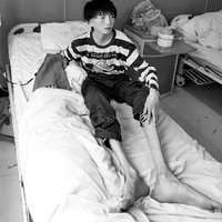 Phi thường - kỳ quặc - Mắc bệnh lạ, cậu bé hóa "người nhện"