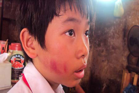 Phẫn nộ cô giáo dùng thước vụt học sinh - 2