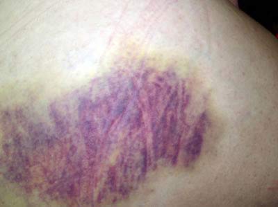 Ghen tuông và bạo lực gia đình - 2