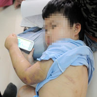 Tin tức trong ngày - Mẹ đi tù, bố dùng búa đinh "dạy" con